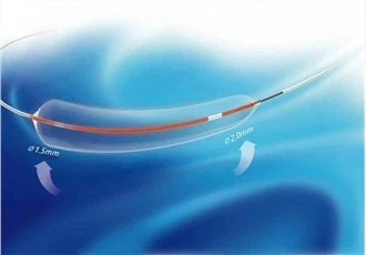 Ống thông khí cầu PTA thuôn nhọn